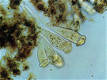微生物の写真